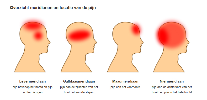 Hoofdpijn Behandelen Met Acupunctuur Jeanine Hofs